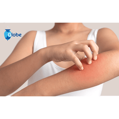 A person in a white tank top scratches their red, irritated forearm, possibly seeking eczema relief with Globe Hydrocortisone Maximum Strength Cream 1% w/ Aloe, 16 oz Jar. The Globe logo appears in the top left corner.