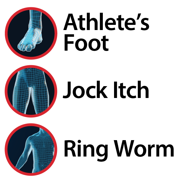 Three labeled diagrams show common areas for fungal infections: foot (Athlete’s Foot), groin (Jock Itch), and torso (Ringworm), each circled in red. Globe Clotrimazole Antifungal Cream 1% relieves itching, burning, and fungus.