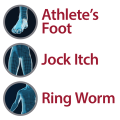 Globe Clotrimazole Solution for Athlete’s Foot, Jock Itch and Ringworm. 10ml Bottle (0.33 FL oz))