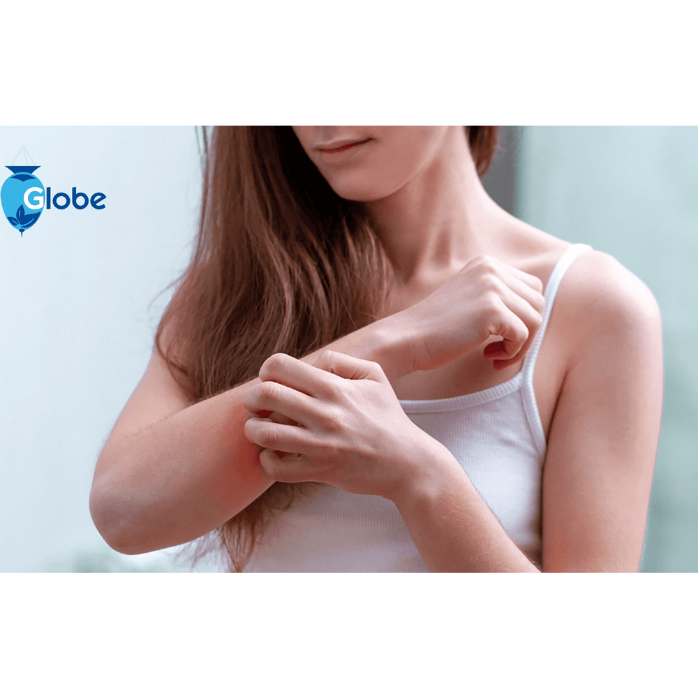 A woman in a white tank top scratches her irritated forearm, possibly seeking relief from itching. The Globe logo is visible, referencing Globe Hydrocortisone 1% Maximum Strength Cream (0.9g), an anti-itch cream for rash and bug bites.