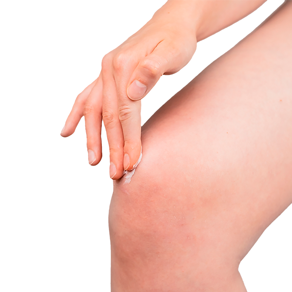 A hand applies Globe Muscle & Joint Vanishing Scent Gel (3 oz) with 2.5% menthol to a knee, showing a close-up of the hand and knee against a white background. This non-greasy pain reliever by Globe eases minor arthritis discomfort.