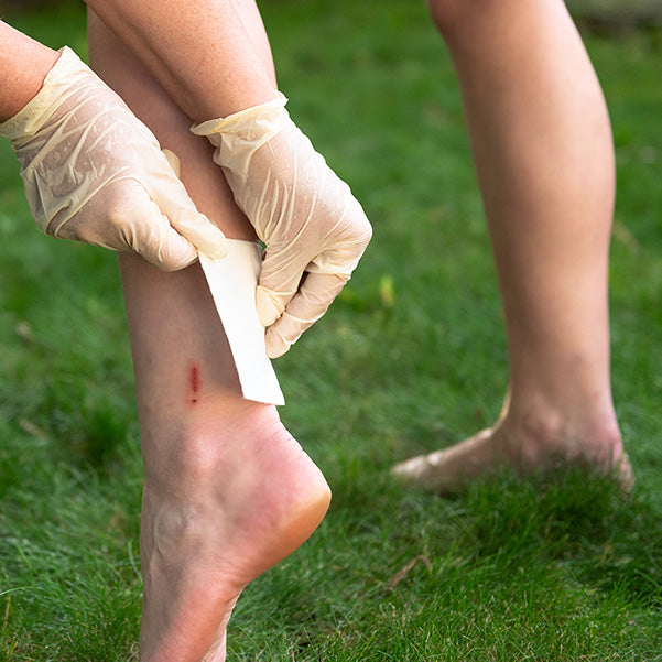 Wearing gloves, a person applies a Globe Sterile Non-Adherent Pad 2" x 3", a highly absorbent, non-stick wound dressing by Globe, to a small leg wound while standing on grass.